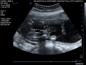 Its a boy