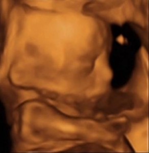 Deiz 4D altrasouns scan